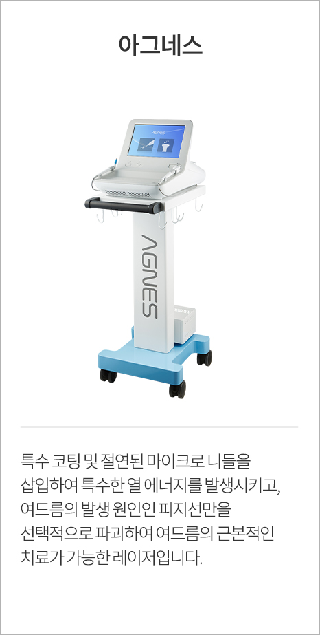 아그네스