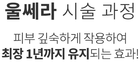 울쎄라 시술과정