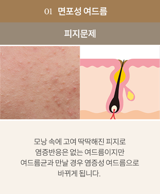 point1