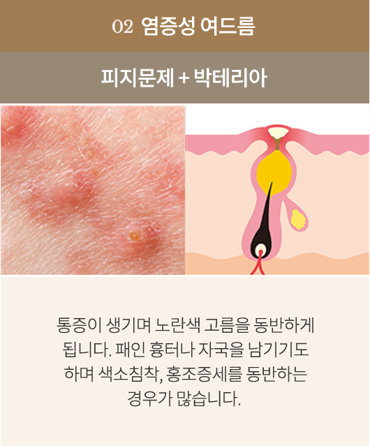 point2