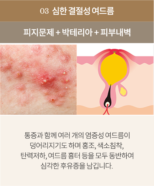 point3