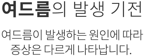 난치성 여드름 발생 기전