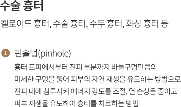 point2
