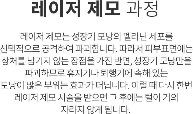 레이저 제모 과정