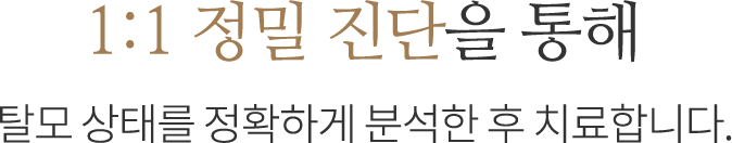 1:1 정밀진단 탈모치료