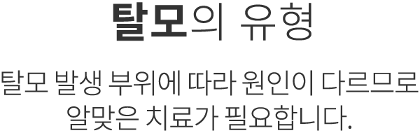 탈모의 유형