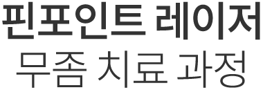핀포인트 레이저 치료과정