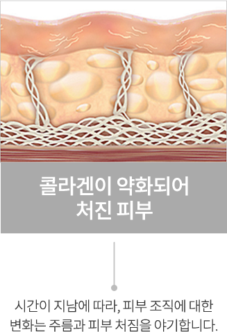point1