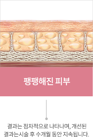 point2