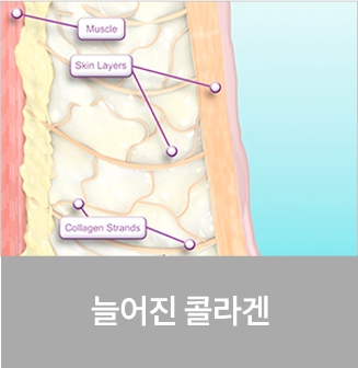 point1