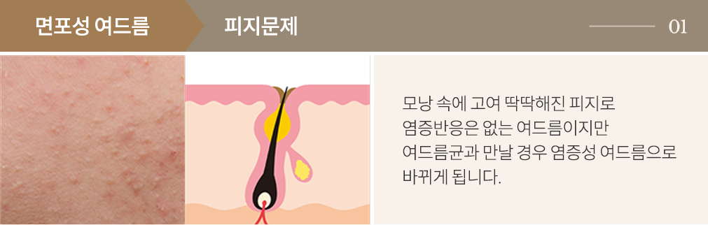 point1