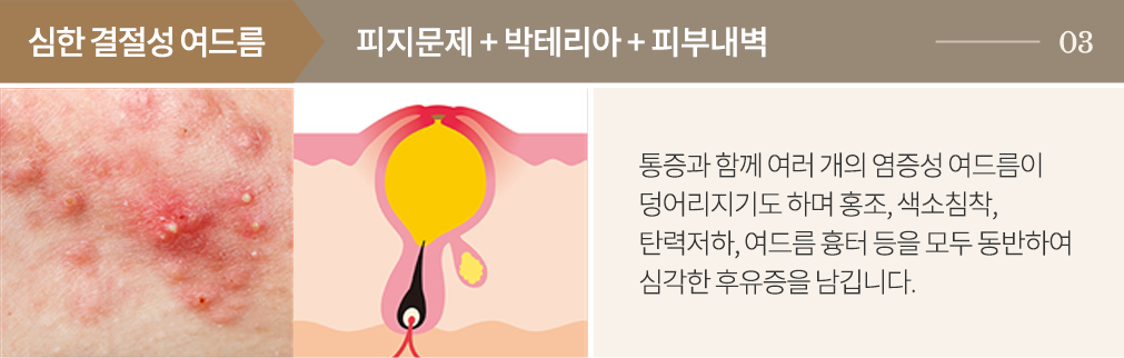 point3