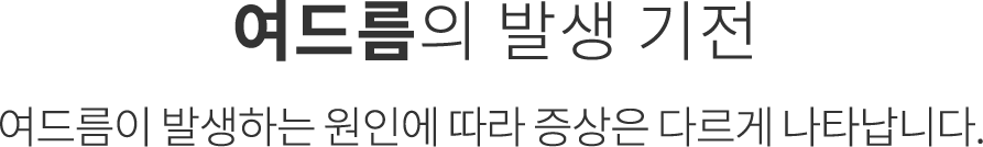 난치성 여드름 발생 기전