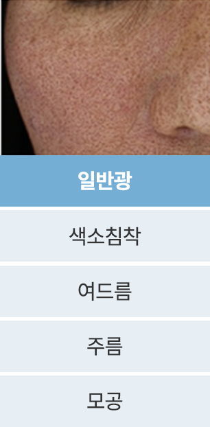point1