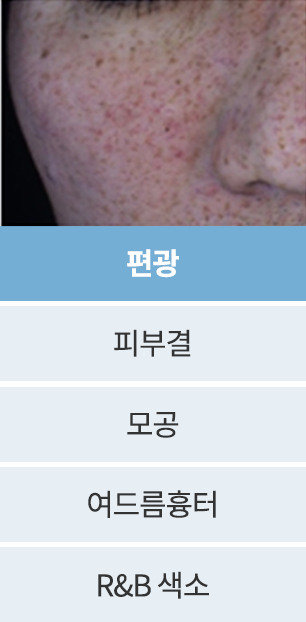 point2