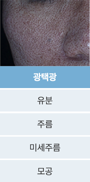 point4