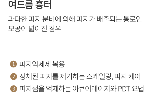 point1