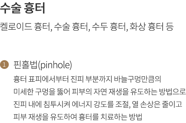 point2