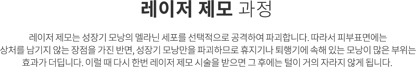 레이저 제모 과정