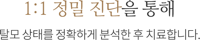 1:1 정밀진단 탈모치료