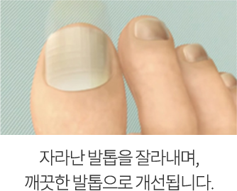 point2